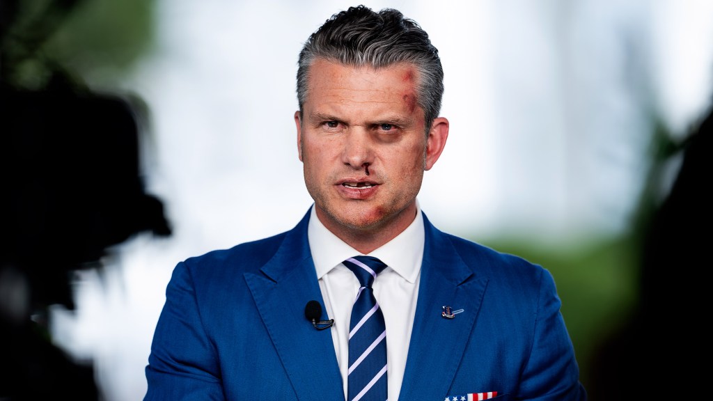 Visibly Bruised Pete Hegseth Declares Wobbly Barstools Threat To National Security